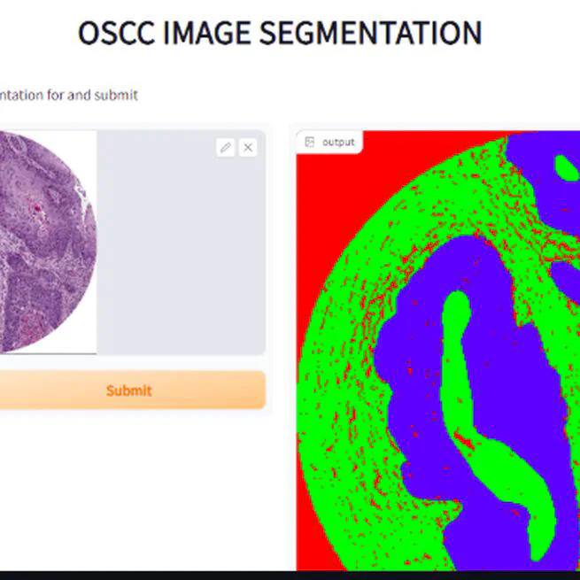 Experimental Comparison of State-of-the-Art Deep Learning Approaches for Oral Squamous Cell Carcinoma Cancer Segmentation